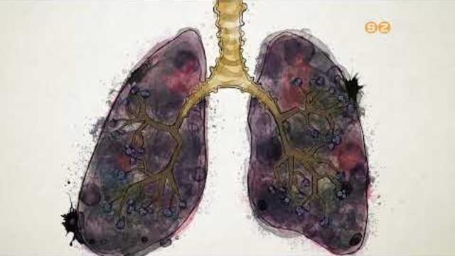 Az EFI szakemberei kiemelten fontosnak tartják a dohányzásról leszokást segítő programot Az EFI szakemberei kiemelten fontosnak tartják a dohányzásról leszokást segítő programot