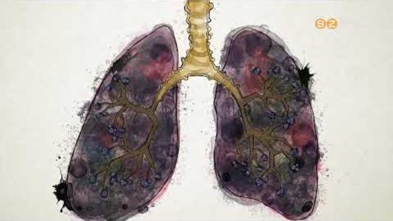 Az EFI szakemberei kiemelten fontosnak tartják a dohányzásról leszokást segítő programot Az EFI szakemberei kiemelten fontosnak tartják a dohányzásról leszokást segítő programot